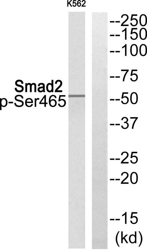 Anti-Phospho-SMAD2 (Ser465) Polyclonal Antibody 2