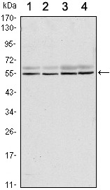 Anti-SMAD6 Antibody (4J476)