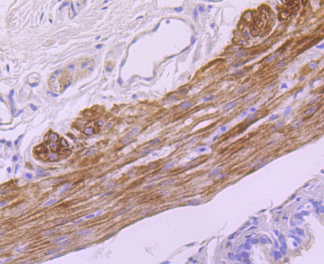 Anti-smooth muscle Myosin heavy chain 11 Antibody (7J784)