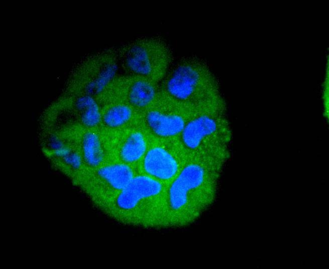 Anti-STAT5B Antibody (1Y166)