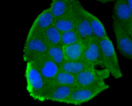 Anti-smooth muscle Myosin heavy chain 11 Antibody (7J784)