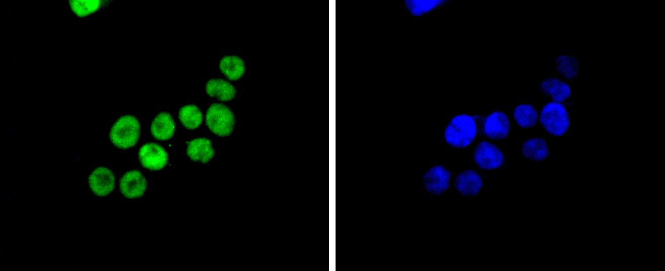 Anti-SMC1A Antibody (7H408)