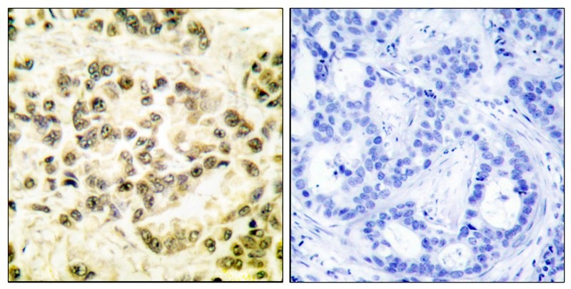 Anti-Phospho-STAT5B (Ser731) Polyclonal Antibody
