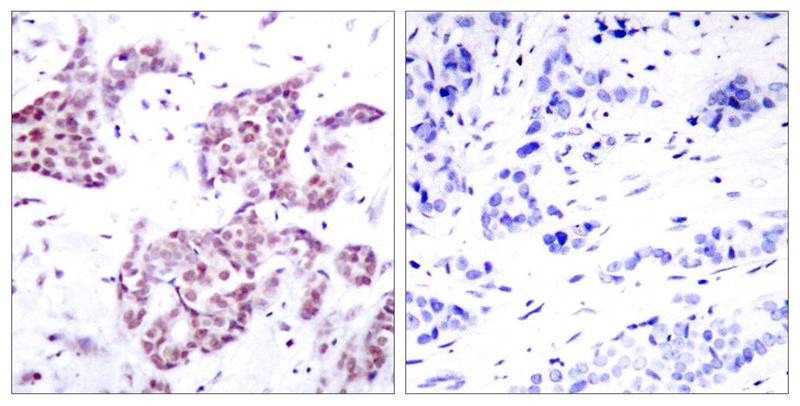 Anti-Phospho-STAT6 (Tyr641) Polyclonal Antibody 2