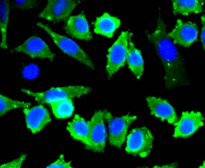 Anti-Stathmin 1 Antibody (2X10)