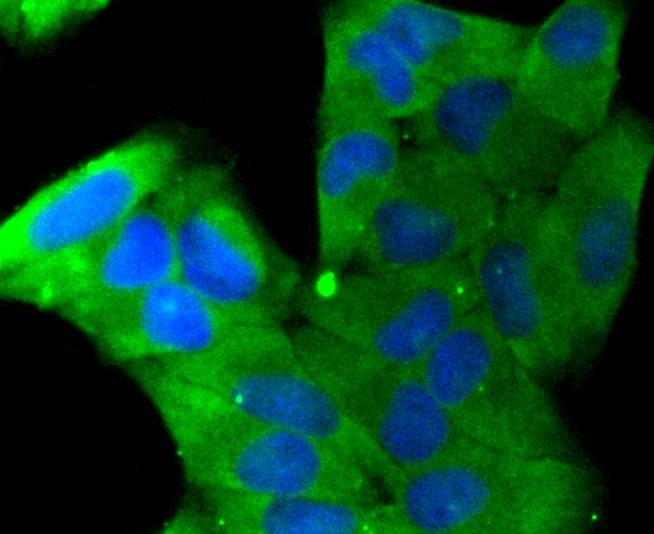 Anti-Stathmin 1 Antibody (2X10)