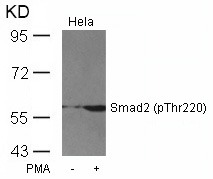 Anti-Phospho-SMAD2 (Thr220) Polyclonal Antibody