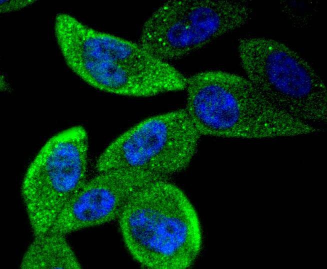 Anti-STAT5B Antibody (1Y166)