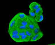 Anti-SMAD1 Antibody (1C774)