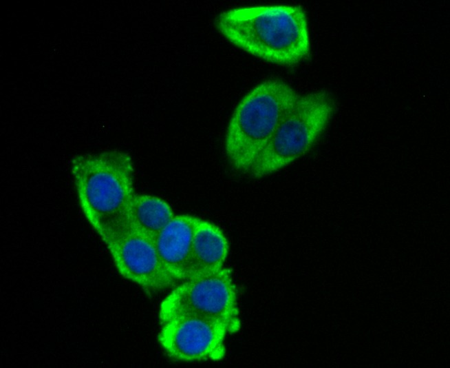 Anti-SOCS2 Antibody (9S693)