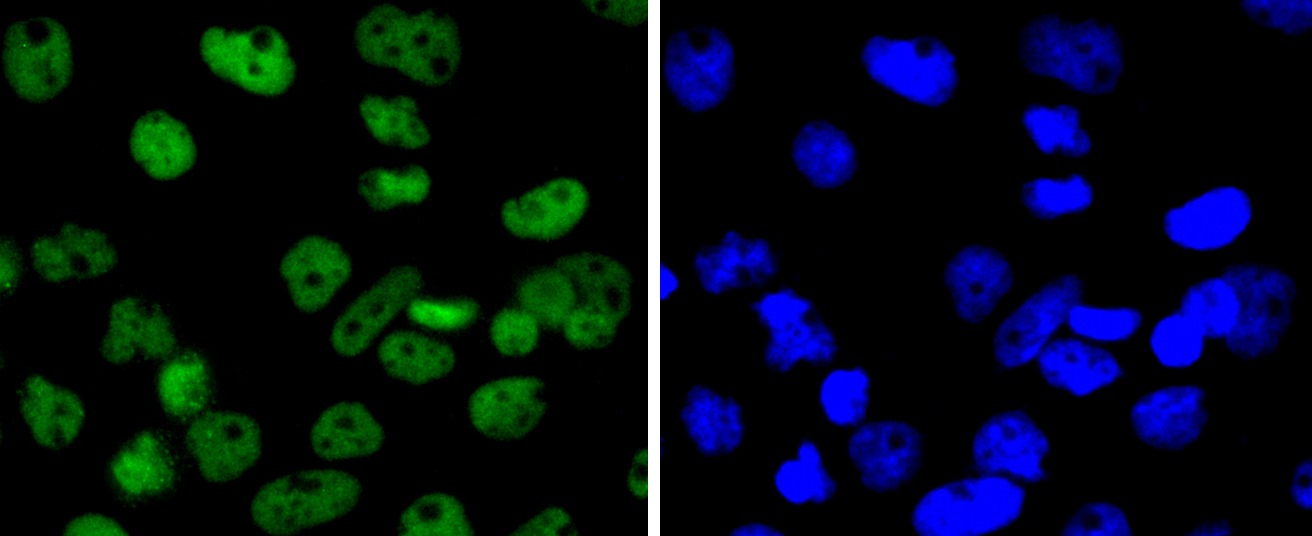 Anti-SMC1A Antibody (7H408)