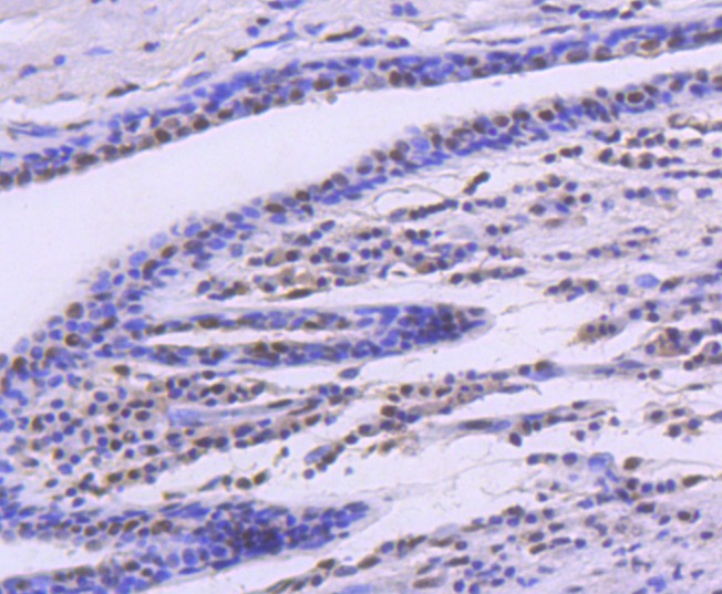 Anti-SMC1A Antibody (7H408)