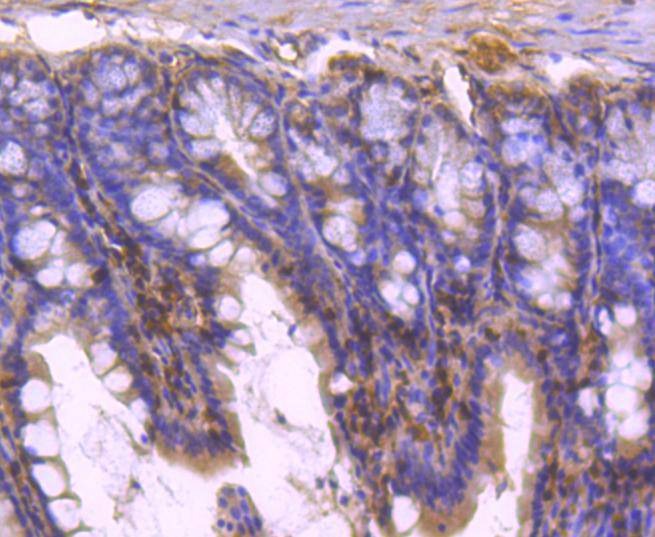 Anti-STAT5B Antibody (1Y166)
