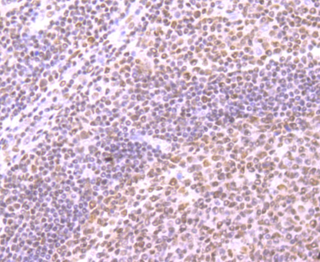 Anti-SMC3 Antibody (2D413)