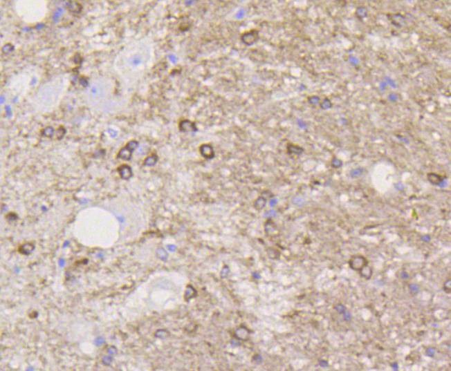 Anti-Stathmin 1 Antibody (2X10)