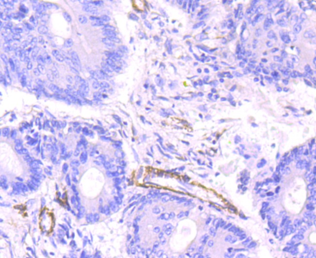 Anti-smooth muscle Myosin heavy chain 11 Antibody (7J784)