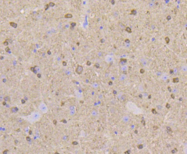 Anti-Stathmin 1 Antibody (2X10)