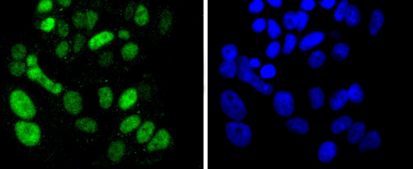 Anti-SOX9 Antibody (7W835)