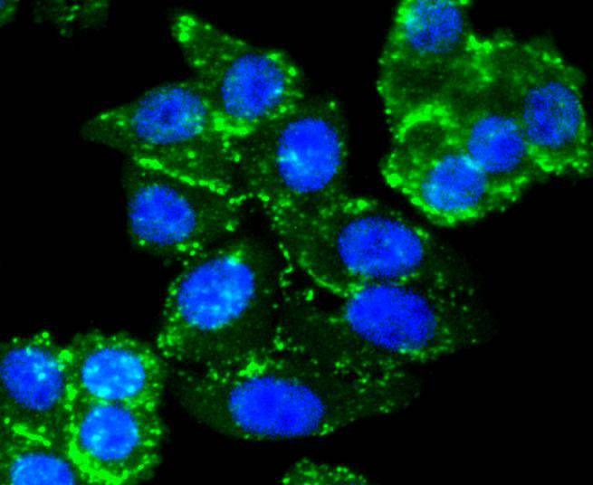 Anti-SMAD3 Antibody (6Y358)