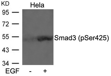 Anti-Phospho-SMAD3 (Ser425) Polyclonal Antibody 2