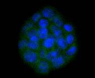 Anti-SOX10 Antibody (3I466)