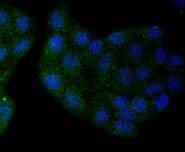 Anti-SOX10 Antibody (3I466)