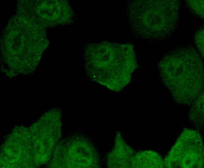 Anti-SMAD5 Antibody (9J928)
