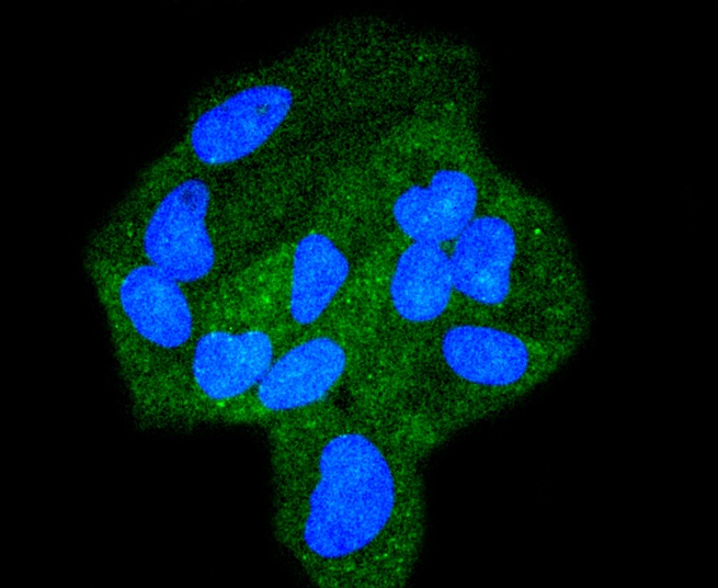 Anti-STAT6 Antibody (1F266)