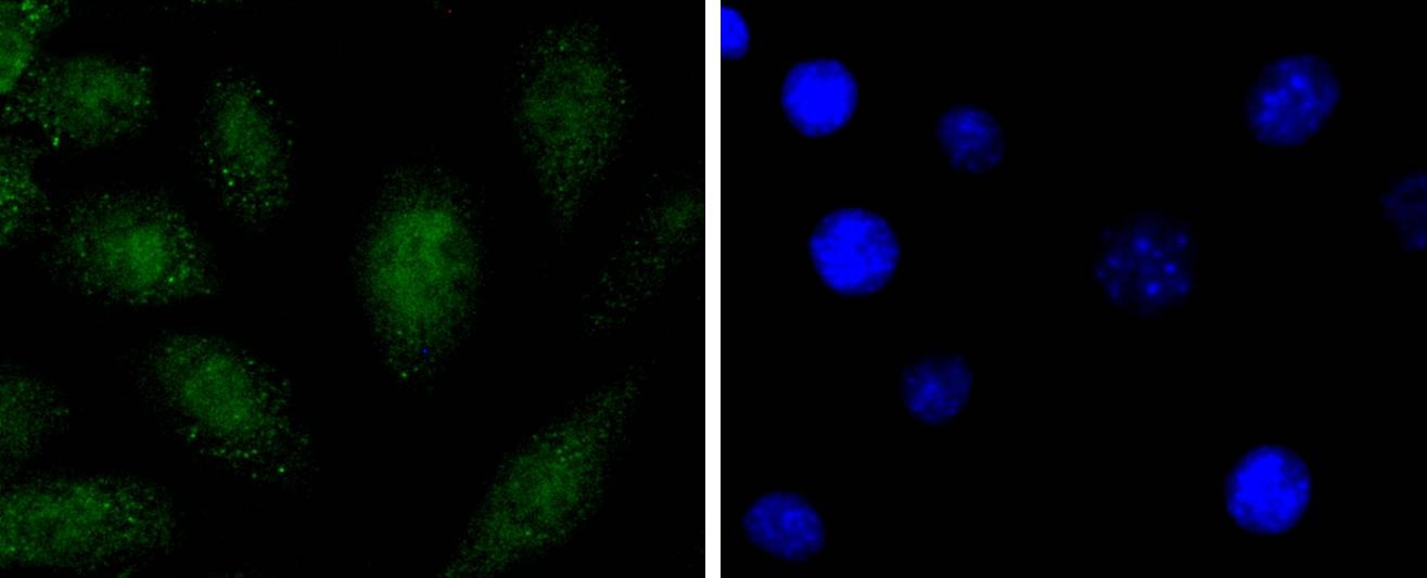 Anti-SOX1 Antibody (1G113)