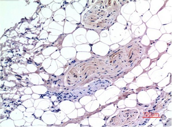Anti-SMAD3 Antibody (9L391)