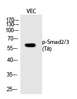 Anti-Phospho-SMAD2/3 (Thr8) Polyclonal Antibody 2