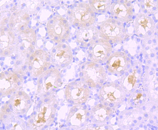 Anti-Sphingosine Kinase 1/SPHK1 Antibody (6L121)