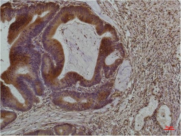 Anti-SMAD3 Antibody (8N368)