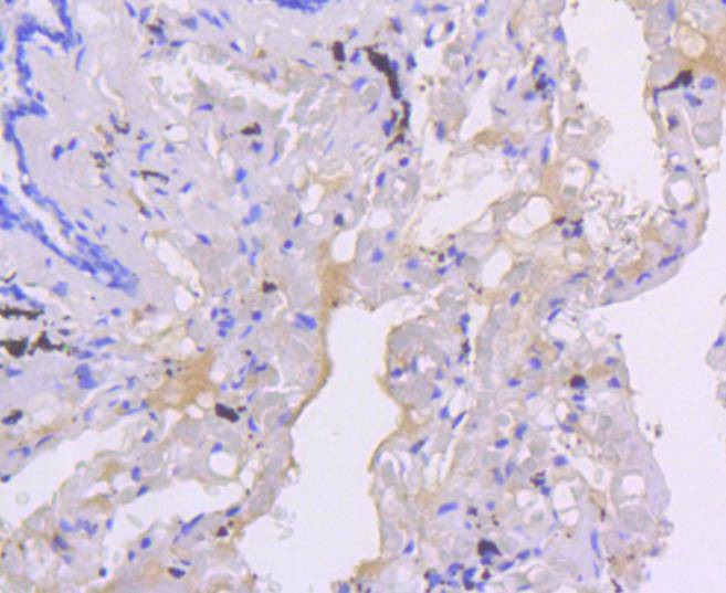 Anti-SMAD5 Antibody (9J928)