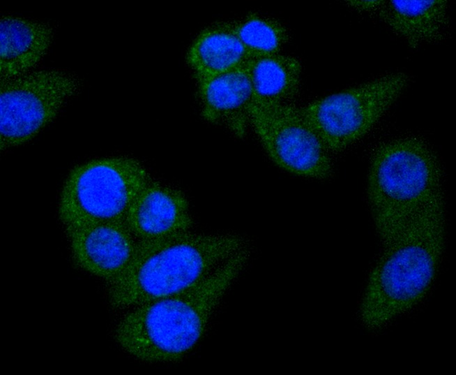 Anti-STAT6 Antibody (1F266)