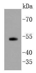 Anti-SMAD5 Antibody (9J928)