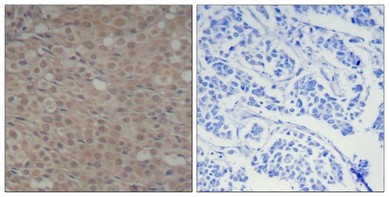 Anti-Phospho-SMAD3 (Ser425) Polyclonal Antibody 2