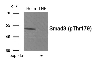 Anti-Phospho-SMAD3 (Thr179) Polyclonal Antibody 2