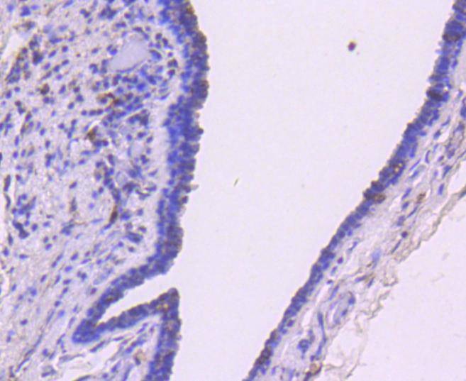Anti-SMAD3 Antibody (6Y358)