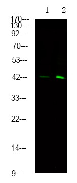 Anti-Phospho-Sphingosine Kinase 1/SPHK1 (Ser225) Polyclonal Antibody