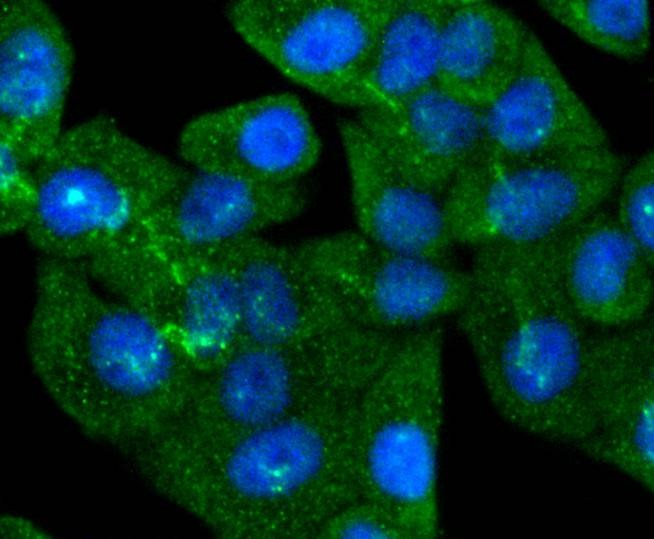 Anti-SMAD5 Antibody (9J928)