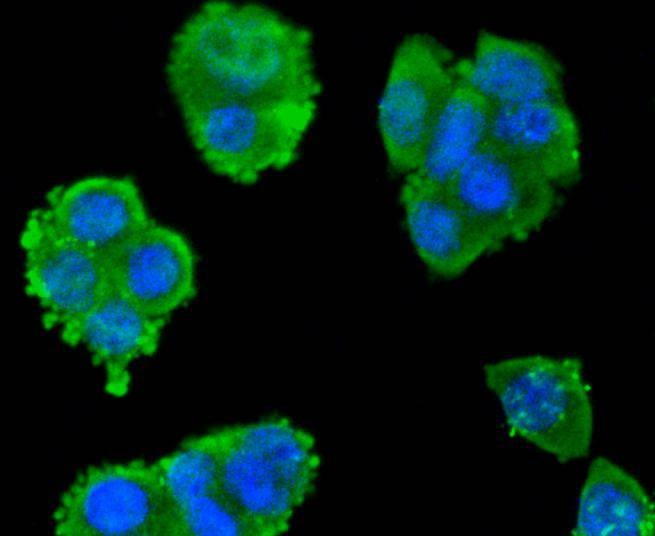 Anti-SMAD3 Antibody (6Y358)