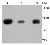 Anti-STAT5A/B Antibody (8D628)
