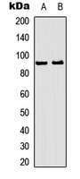 Anti-Phospho-RSK1/2/3 (Thr573/570/577) Polyclonal Antibody