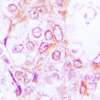 Anti-Phospho-RSK1/2/3 (Thr573/570/577) Polyclonal Antibody