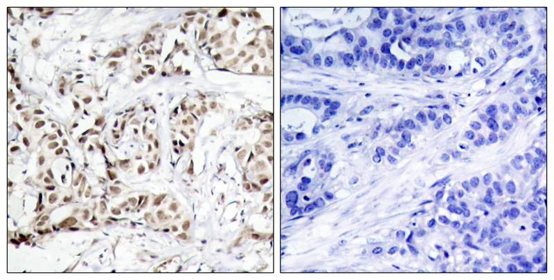 Anti-Phospho-JNK2 (Thr183) Polyclonal Antibody