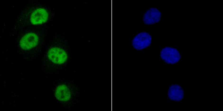 Anti-SAMHD1 Antibody (8T611)