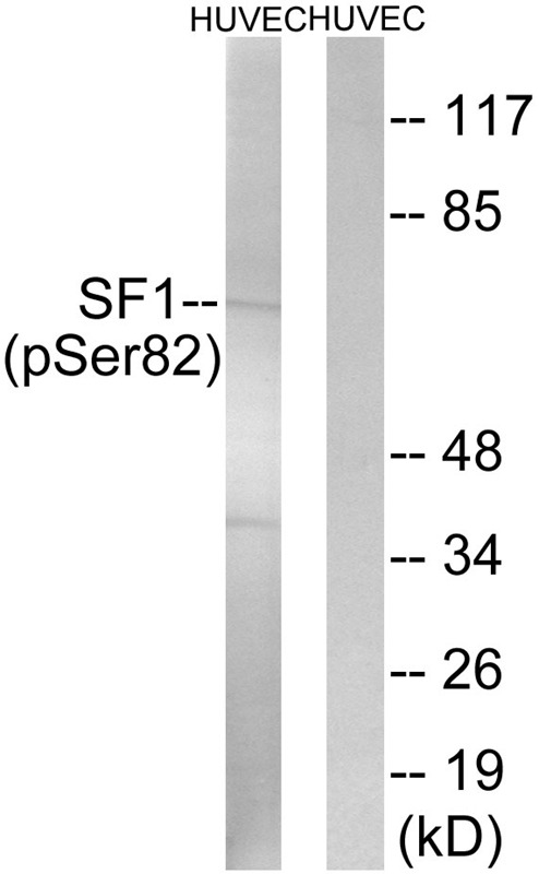 Anti-Phospho-SF1 (Ser82) Polyclonal Antibody