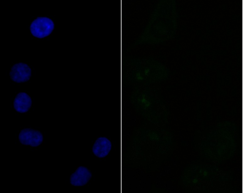 Anti-SF3B3 Antibody (4H951)