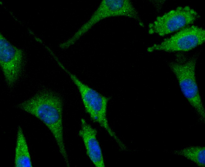 Anti-SENP1 Antibody (8Q886)